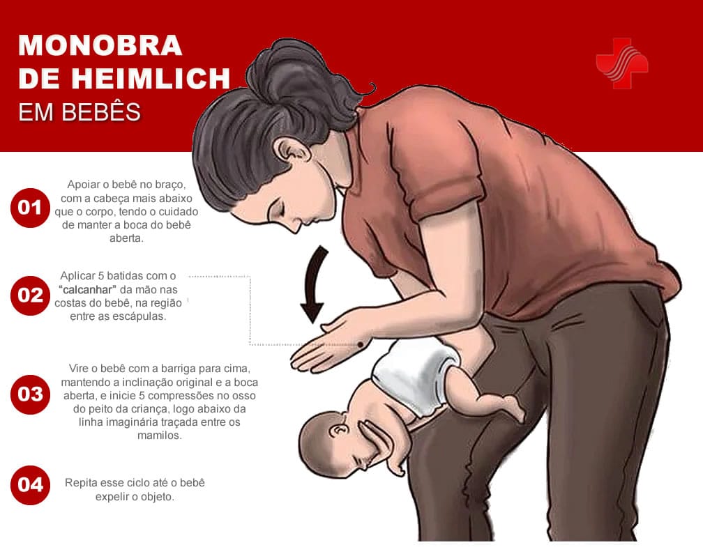 Manobra de Heimlilich em Bebês